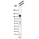 Western Blot - Anti-Sarcomeric Actinin alpha 2 Antibody [ACTN2/3292] (A250448) - Antibodies.com