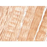 Immunohistochemistry - Anti-Sarcomeric Actinin alpha 2 Antibody [ACTN2/3293] (A250449) - Antibodies.com