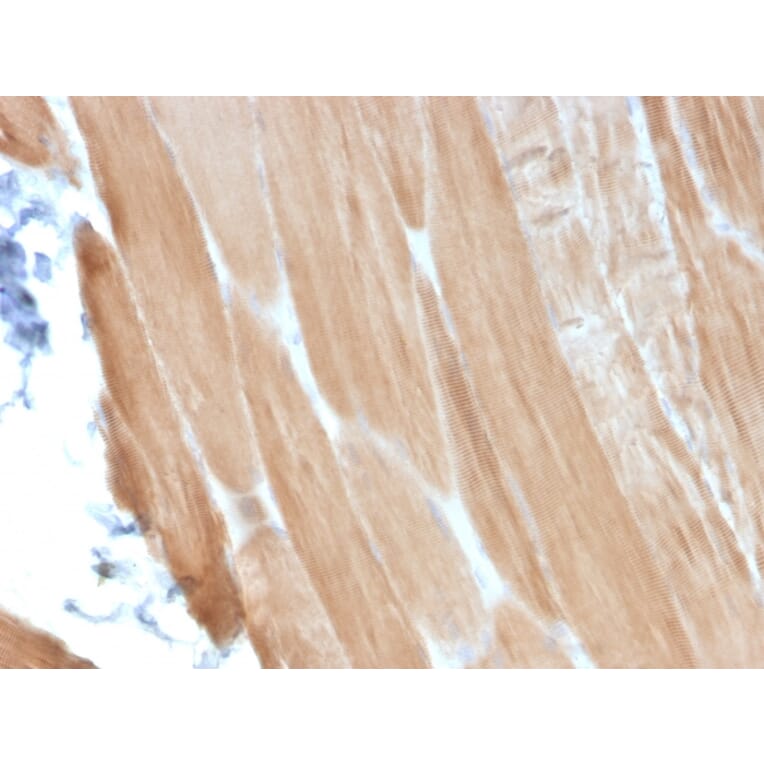 Immunohistochemistry - Anti-Sarcomeric Actinin alpha 2 Antibody [ACTN2/3293] (A250449) - Antibodies.com