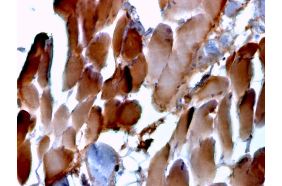 Immunohistochemistry - Anti-Sarcomeric Actinin alpha 2 Antibody [ACTN2/3293] (A250449) - Antibodies.com