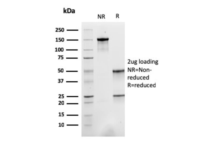 SDS-PAGE - Anti-Sarcomeric Actinin alpha 2 Antibody [ACTN2/3293] (A250449) - Antibodies.com