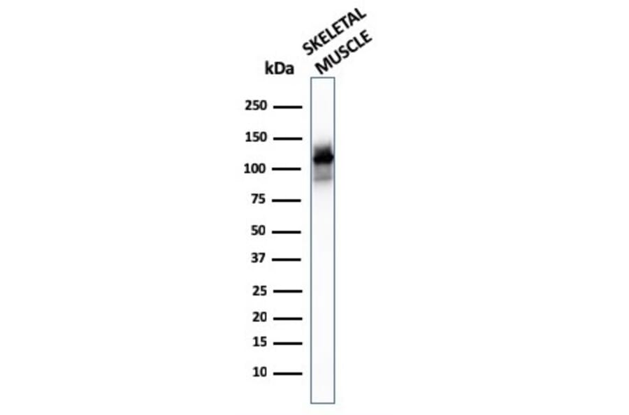 Western Blot - Anti-Sarcomeric Actinin alpha 2 Antibody [ACTN2/3293] (A250449) - Antibodies.com