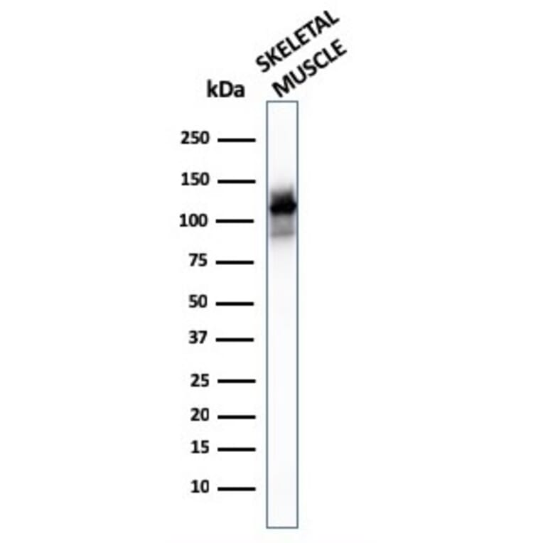 Western Blot - Anti-Sarcomeric Actinin alpha 2 Antibody [ACTN2/3293] (A250449) - Antibodies.com