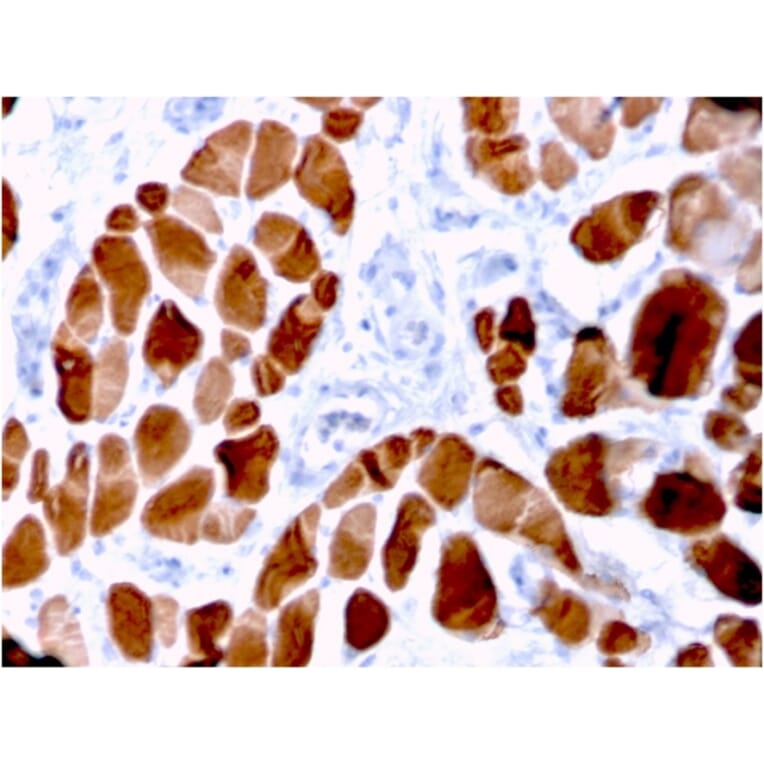 Immunohistochemistry - Anti-Sarcomeric Actinin alpha 2 Antibody [ACTN2/3294] (A250450) - Antibodies.com