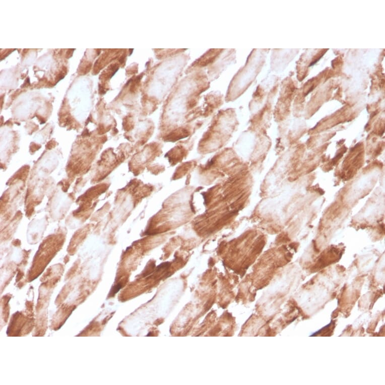 Immunohistochemistry - Anti-Sarcomeric Actinin alpha 2 Antibody [ACTN2/3294] (A250450) - Antibodies.com