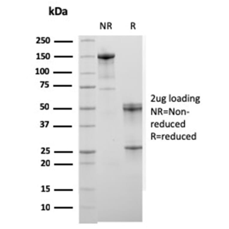 SDS-PAGE - Anti-Sarcomeric Actinin alpha 2 Antibody [ACTN2/3294] (A250450) - Antibodies.com