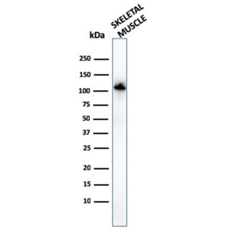 Western Blot - Anti-Sarcomeric Actinin alpha 2 Antibody [ACTN2/3294] (A250450) - Antibodies.com