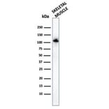 Western Blot - Anti-Sarcomeric Actinin alpha 2 Antibody [ACTN2/3294] (A250450) - Antibodies.com