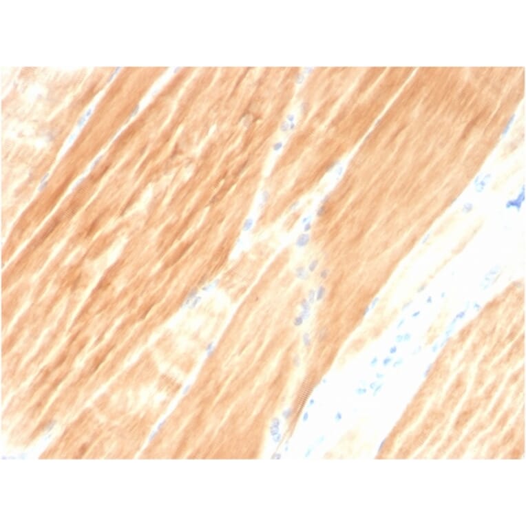 Immunohistochemistry - Anti-Sarcomeric Actinin alpha 2 Antibody [ACTN2/3295] (A250451) - Antibodies.com
