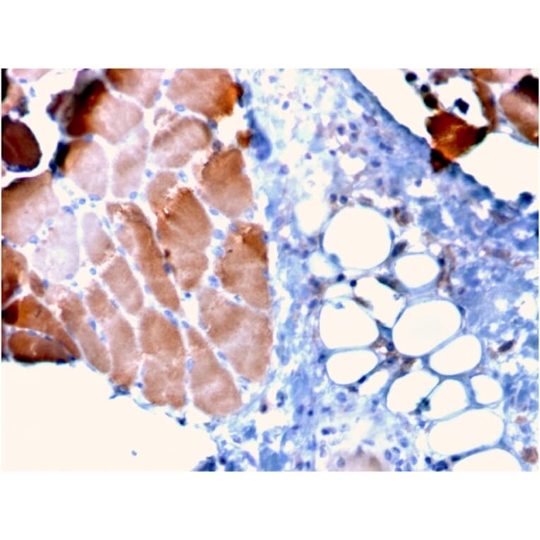 Immunohistochemistry - Anti-Sarcomeric Actinin alpha 2 Antibody [ACTN2/3295] (A250451) - Antibodies.com