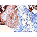 Immunohistochemistry - Anti-Sarcomeric Actinin alpha 2 Antibody [ACTN2/3295] (A250451) - Antibodies.com