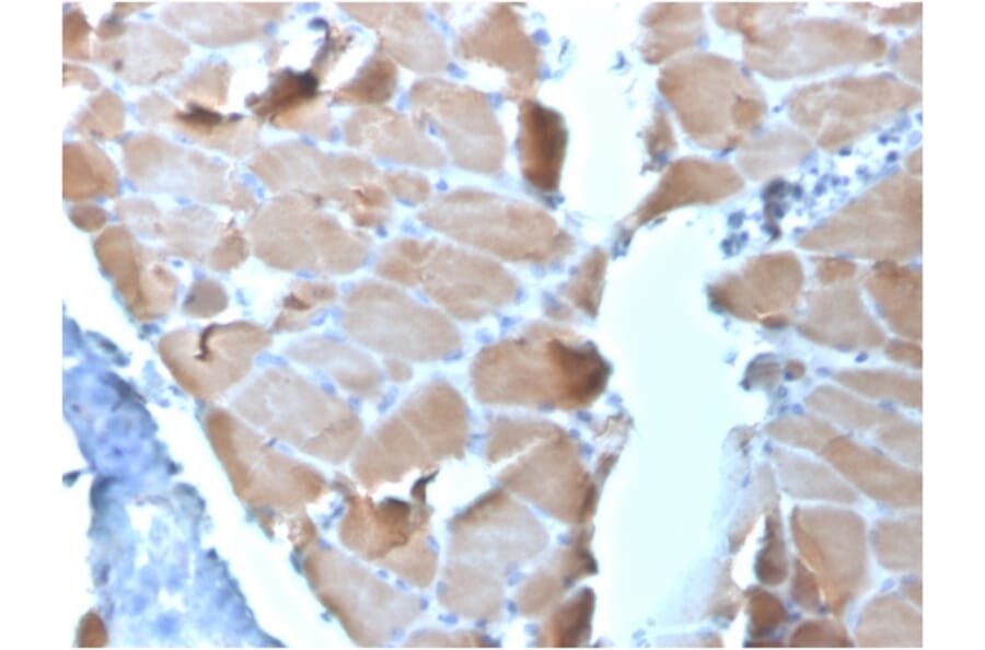 Immunohistochemistry - Anti-Sarcomeric Actinin alpha 2 Antibody [ACTN2/3295] (A250451) - Antibodies.com