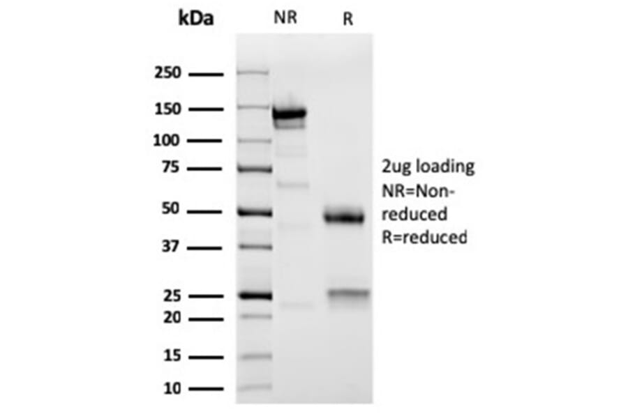 SDS-PAGE - Anti-Sarcomeric Actinin alpha 2 Antibody [ACTN2/3295] (A250451) - Antibodies.com
