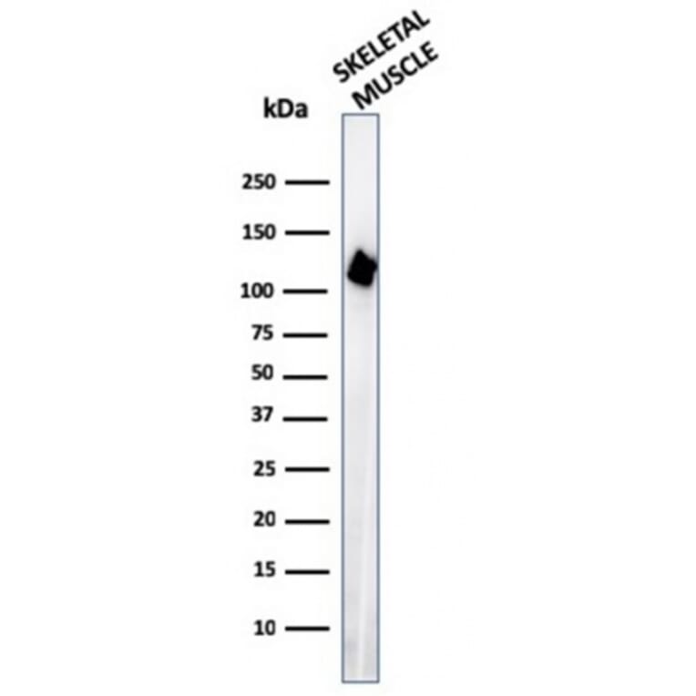 Western Blot - Anti-Sarcomeric Actinin alpha 2 Antibody [ACTN2/3295] (A250451) - Antibodies.com