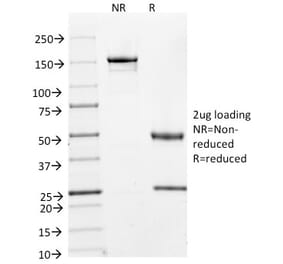 SDS-PAGE - Anti-Cyclin A2 Antibody [E67] (A250452) - Antibodies.com