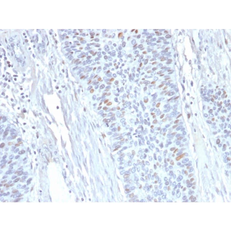 Immunohistochemistry - Anti-Cyclin A2 Antibody [E67] (A250451) - Antibodies.com