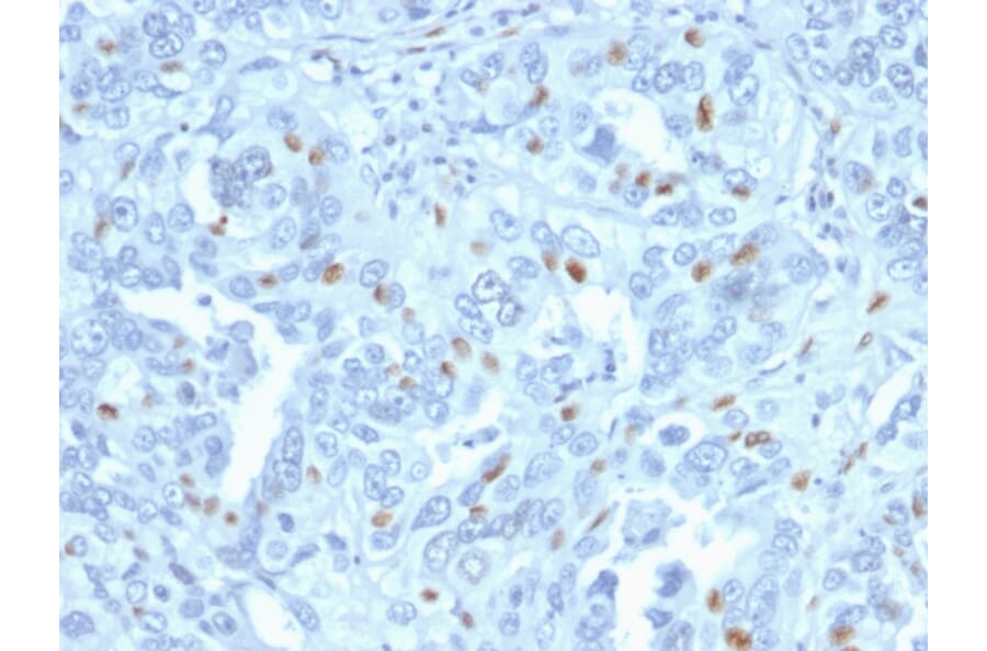 Immunohistochemistry - Anti-Cyclin A2 Antibody [CCNA2/2333] (A250453) - Antibodies.com