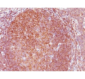 Immunohistochemistry - Anti-BCL10 Antibody [BL10/411] (A250454) - Antibodies.com