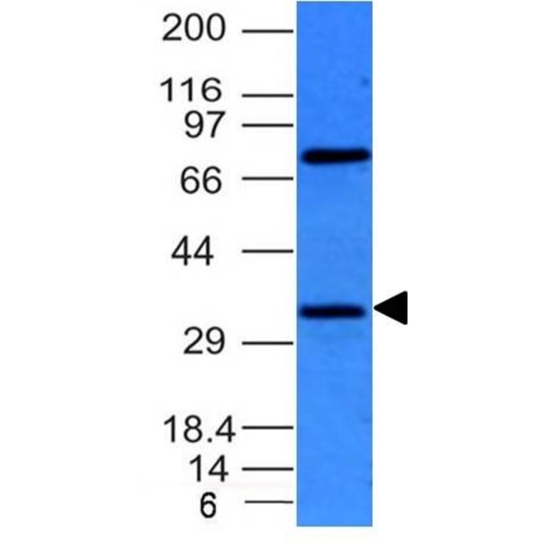 Western Blot - Anti-BCL10 Antibody [BL10/411] (A250454) - Antibodies.com