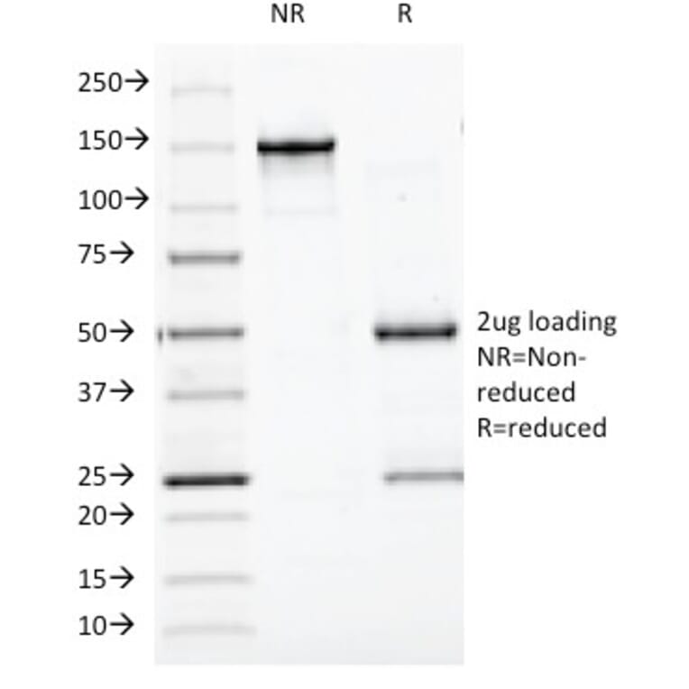 SDS-PAGE - Anti-BCL10 Antibody [BL10/411] (A250454) - Antibodies.com