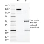 SDS-PAGE - Anti-BCL10 Antibody [BL10/411] (A250454) - Antibodies.com