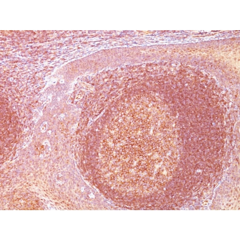 Immunohistochemistry - Anti-BCL10 Antibody [SPM520] (A250454) - Antibodies.com