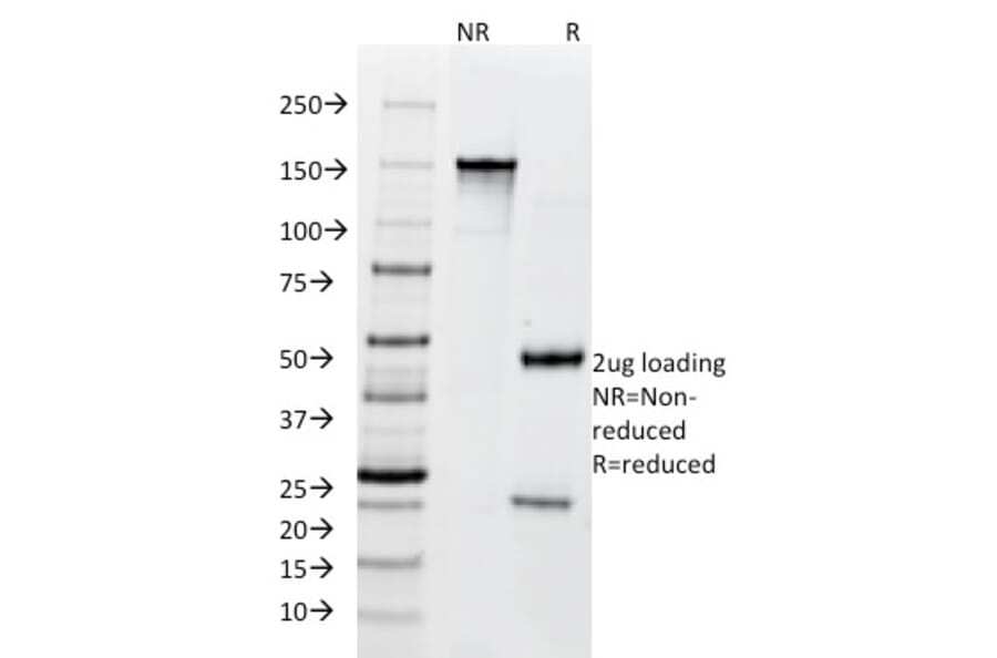 SDS-PAGE - Anti-BCL10 Antibody [SPM520] (A250455) - Antibodies.com