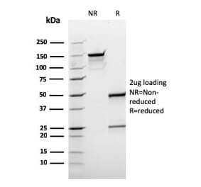 SDS-PAGE - Anti-BCL10 Antibody [rBL10/411] (A250457) - Antibodies.com