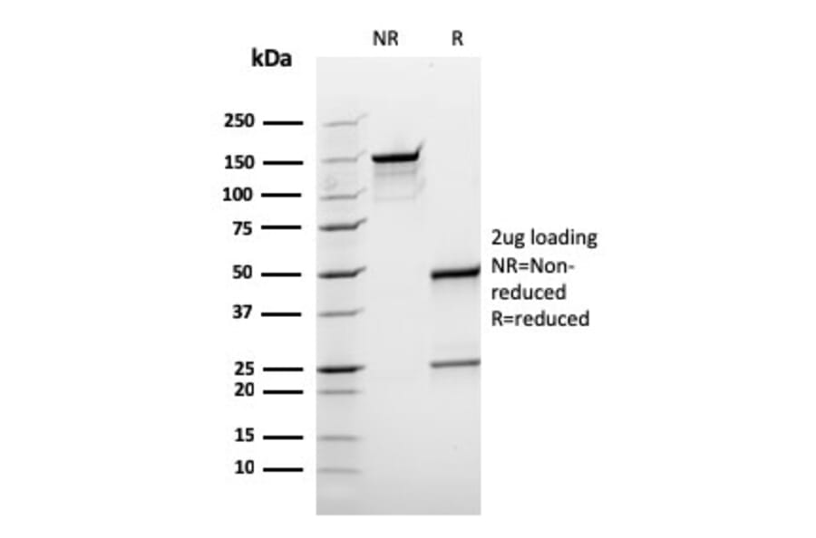 SDS-PAGE - Anti-BCL10 Antibody [rBL10/411] (A250457) - Antibodies.com