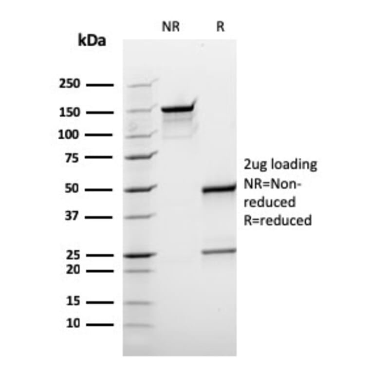 SDS-PAGE - Anti-BCL10 Antibody [rBL10/411] (A250457) - Antibodies.com