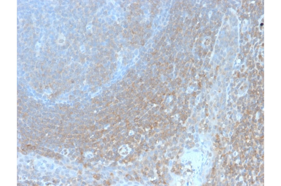 Immunohistochemistry - Anti-BCL10 Antibody [BL10/2988R] (A250458) - Antibodies.com