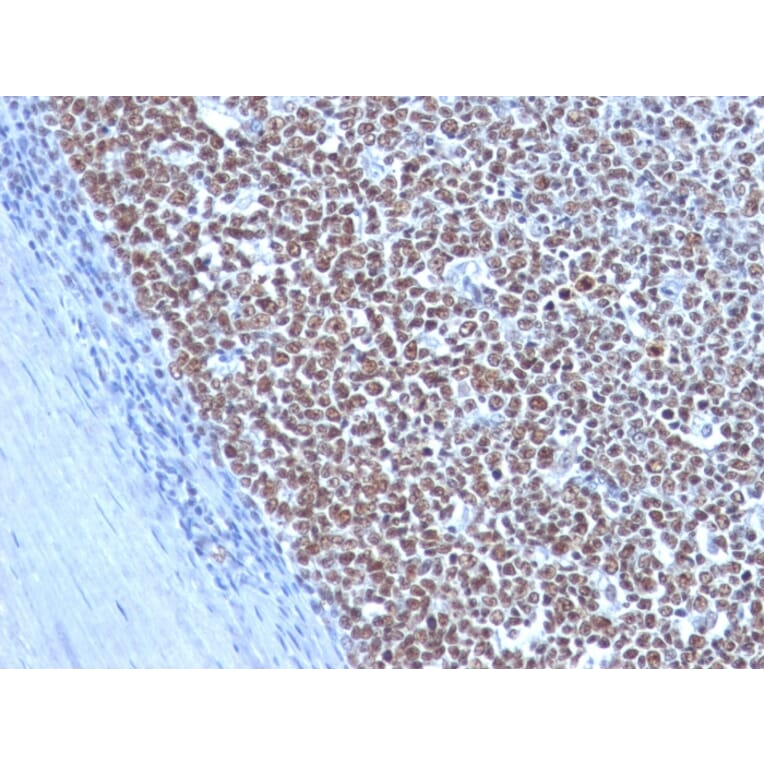 Immunohistochemistry - Anti-Cyclin B1 Antibody [CCNB1/1098] (A250460) - Antibodies.com