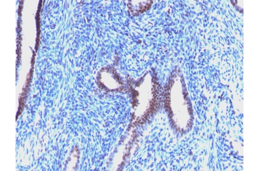 Immunohistochemistry - Anti-Cyclin B1 Antibody [CCNB1/1098] (A250460) - Antibodies.com