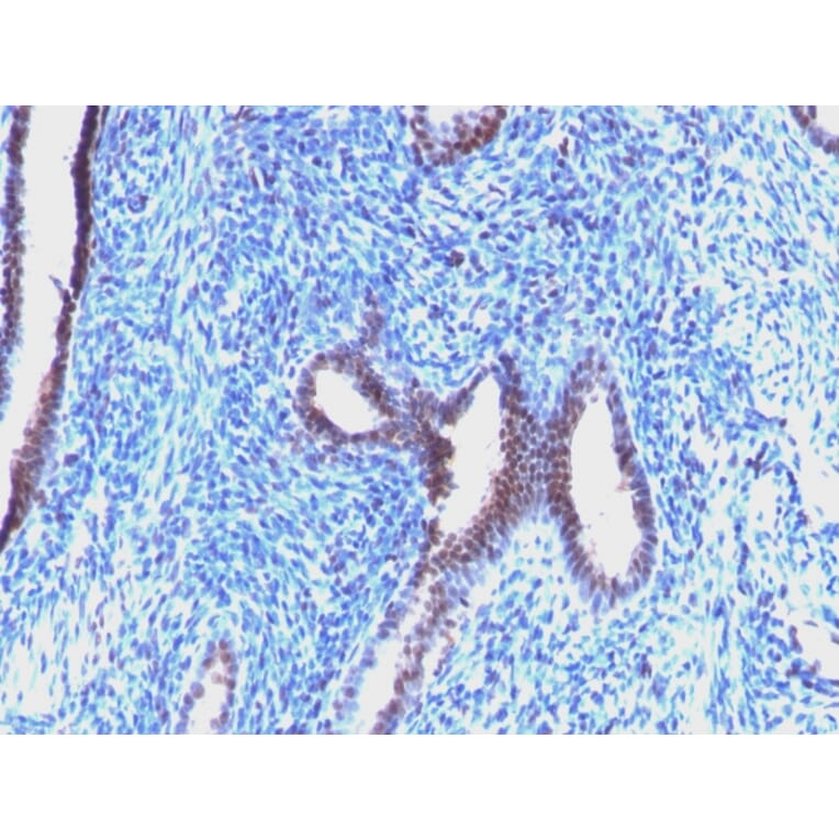 Immunohistochemistry - Anti-Cyclin B1 Antibody [CCNB1/1098] (A250460) - Antibodies.com