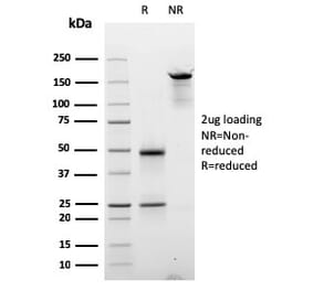 SDS-PAGE - Anti-Cyclin D2 Antibody [CCND2/2620] (A250462) - Antibodies.com