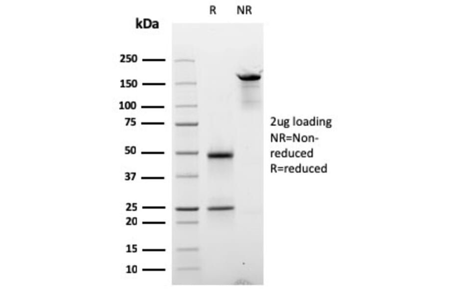 SDS-PAGE - Anti-Cyclin D2 Antibody [CCND2/2620] (A250462) - Antibodies.com