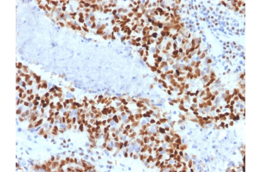 Immunohistochemistry - Anti-Cyclin E Antibody [CCNE1/2460] (A250463) - Antibodies.com