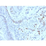 Immunohistochemistry - Anti-Cyclin E Antibody [CCNE1/2460] (A250463) - Antibodies.com