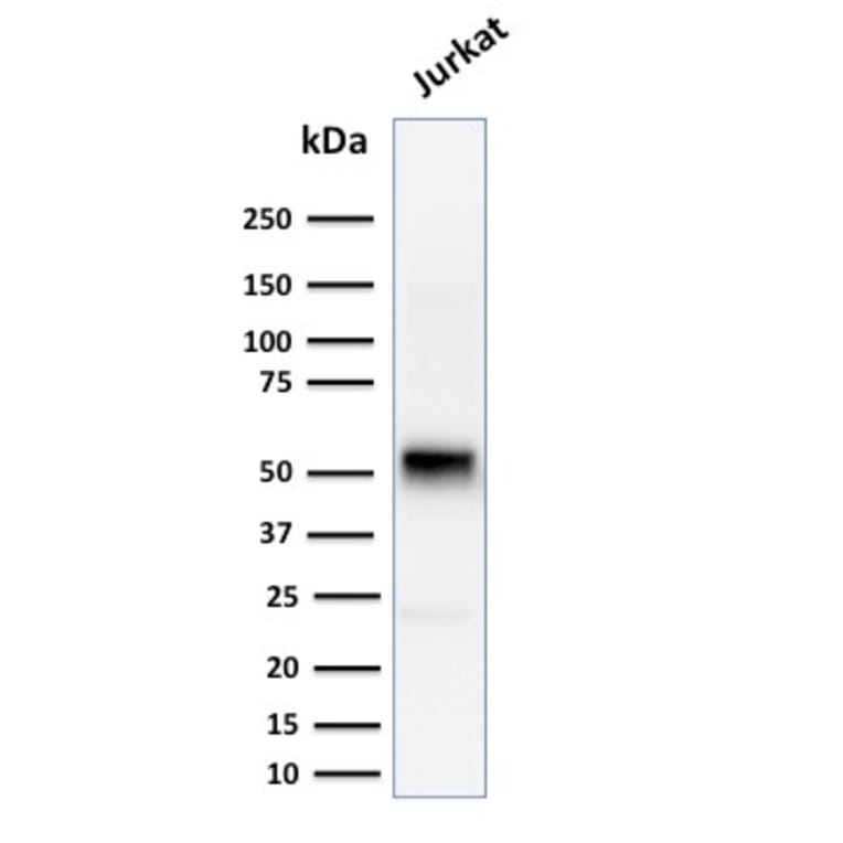 Western Blot - Anti-Cyclin E Antibody [CCNE1/2460] (A250463) - Antibodies.com