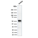 Western Blot - Anti-Cyclin E Antibody [CCNE1/2460] (A250463) - Antibodies.com