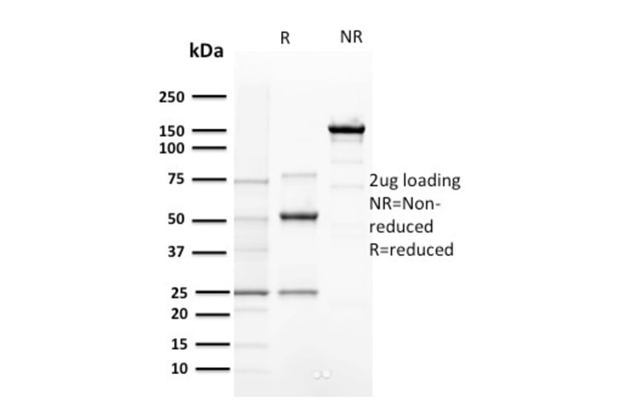 SDS-PAGE - Anti-Cyclin E Antibody [CCNE1/2460] (A250463) - Antibodies.com