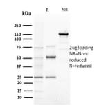 SDS-PAGE - Anti-Cyclin E Antibody [CCNE1/2460] (A250463) - Antibodies.com