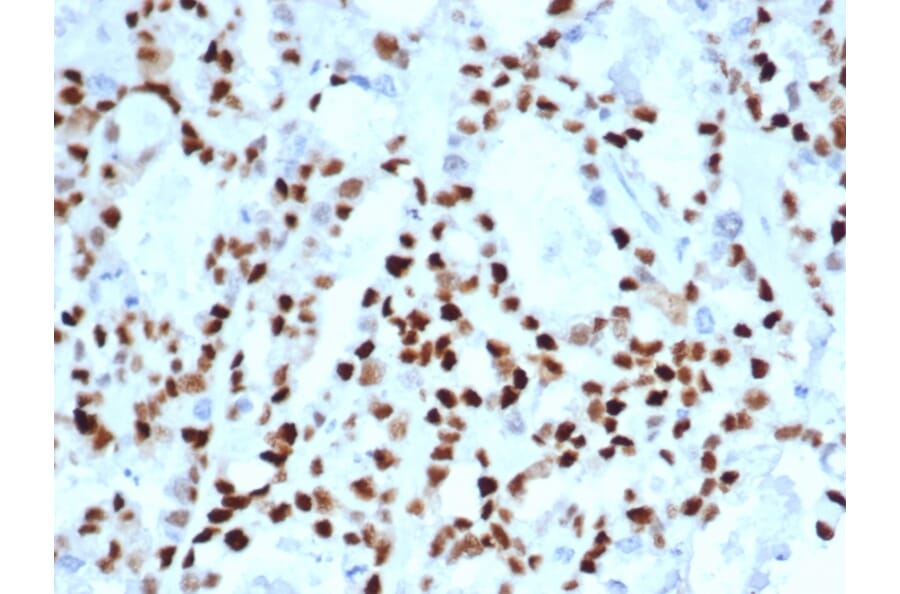 Immunohistochemistry - Anti-Cyclin E Antibody [CCNE1/4935R] (A250465) - Antibodies.com