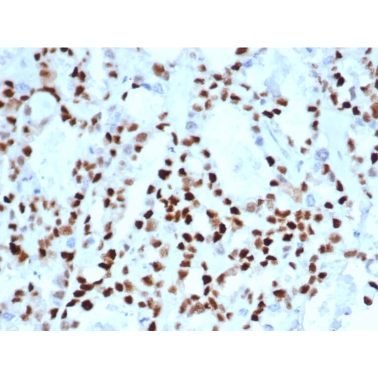 Immunohistochemistry - Anti-Cyclin E Antibody [CCNE1/4935R] (A250465) - Antibodies.com
