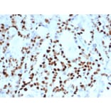 Immunohistochemistry - Anti-Cyclin E Antibody [CCNE1/4935R] (A250465) - Antibodies.com
