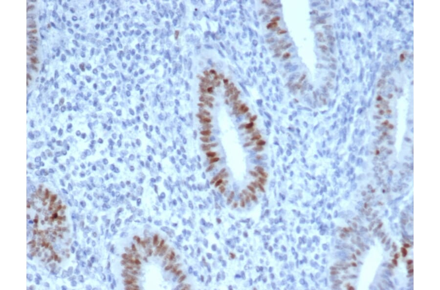 Immunohistochemistry - Anti-Cyclin E Antibody [CCNE1/4935R] (A250464) - Antibodies.com