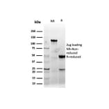 SDS-PAGE - Anti-Cyclin E Antibody [CCNE1/4935R] (A250465) - Antibodies.com
