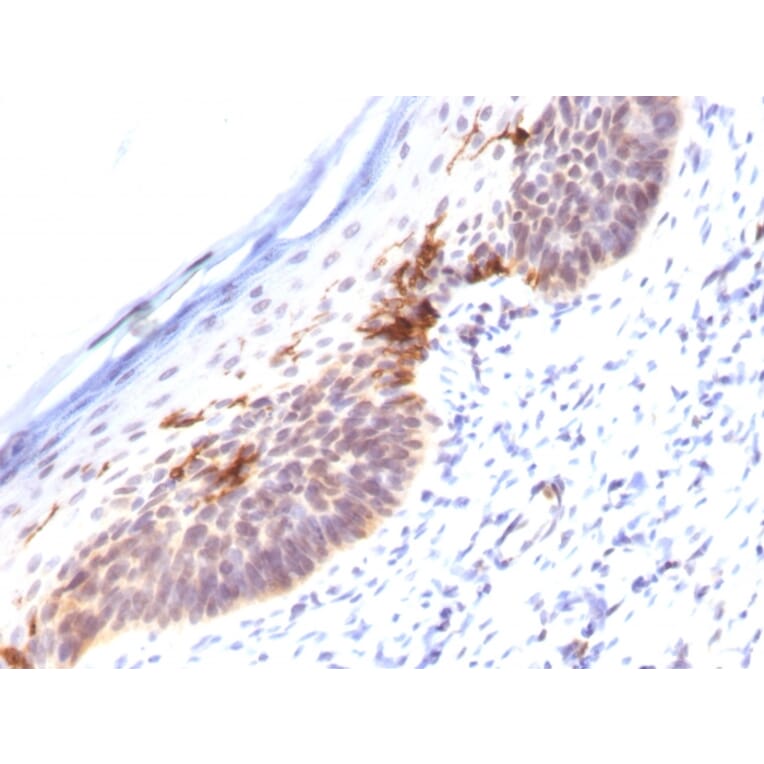 Immunohistochemistry - Anti-CD1a Antibody [SPM120] (A250468) - Antibodies.com