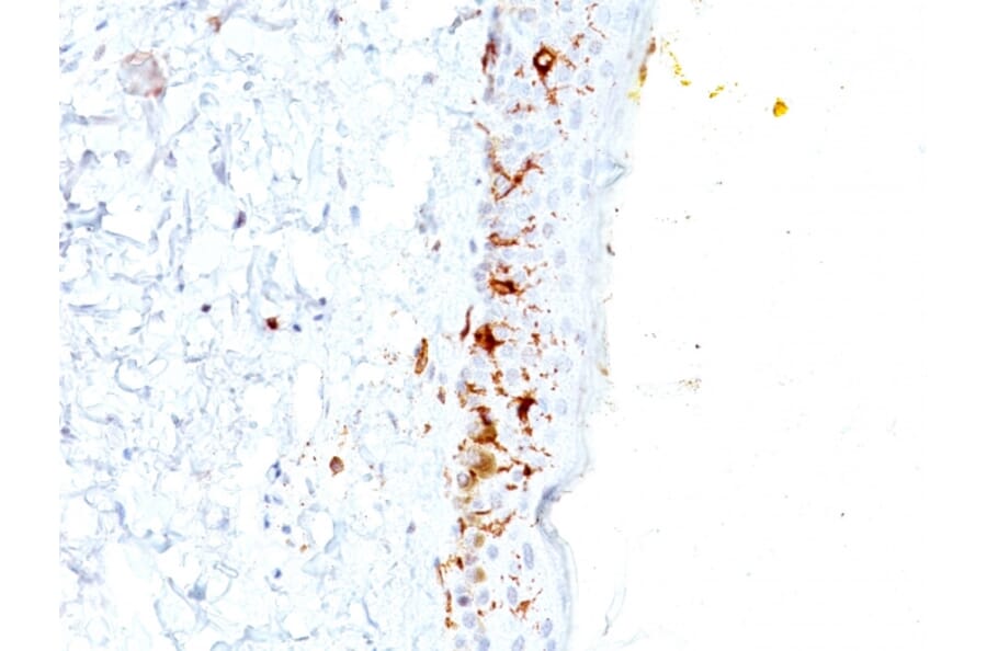 Immunohistochemistry - Anti-CD1a Antibody [C1A/711] (A250469) - Antibodies.com