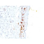 Immunohistochemistry - Anti-CD1a Antibody [C1A/711] (A250469) - Antibodies.com